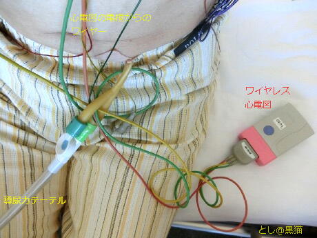 ワイヤレス心電図と導尿カテ